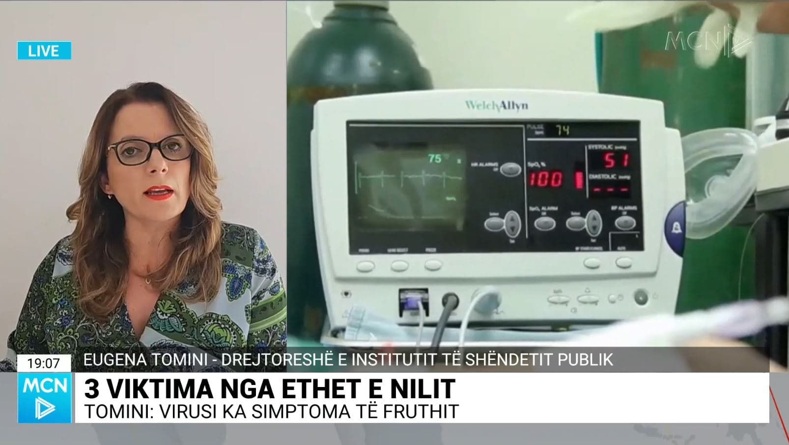 3 viktima nga ethet e Nilit/ Tomini: Rastet vijnë nga Lushnja, Fieri, Kurbini. Virusi s’mund të trajtohet në kushte shtëpie
