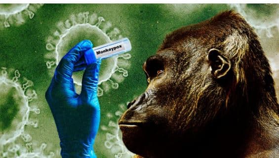 Lija e majmunit (mpox) prek më shumë fëmijët, më të rrezikuar ata nën moshën 5 vjeç