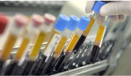 Testi i gjakut mund të parashikojë rrezikun e sulmit në zemër dhe goditjes në tru