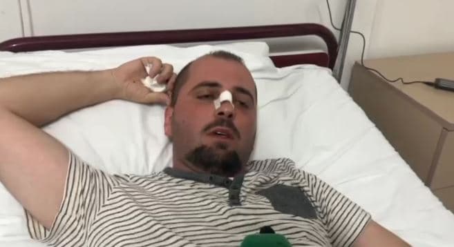 Babë e bir dhunojnë punonjësin e Policisë Bashkiake Vlorë, vihen nën hetim