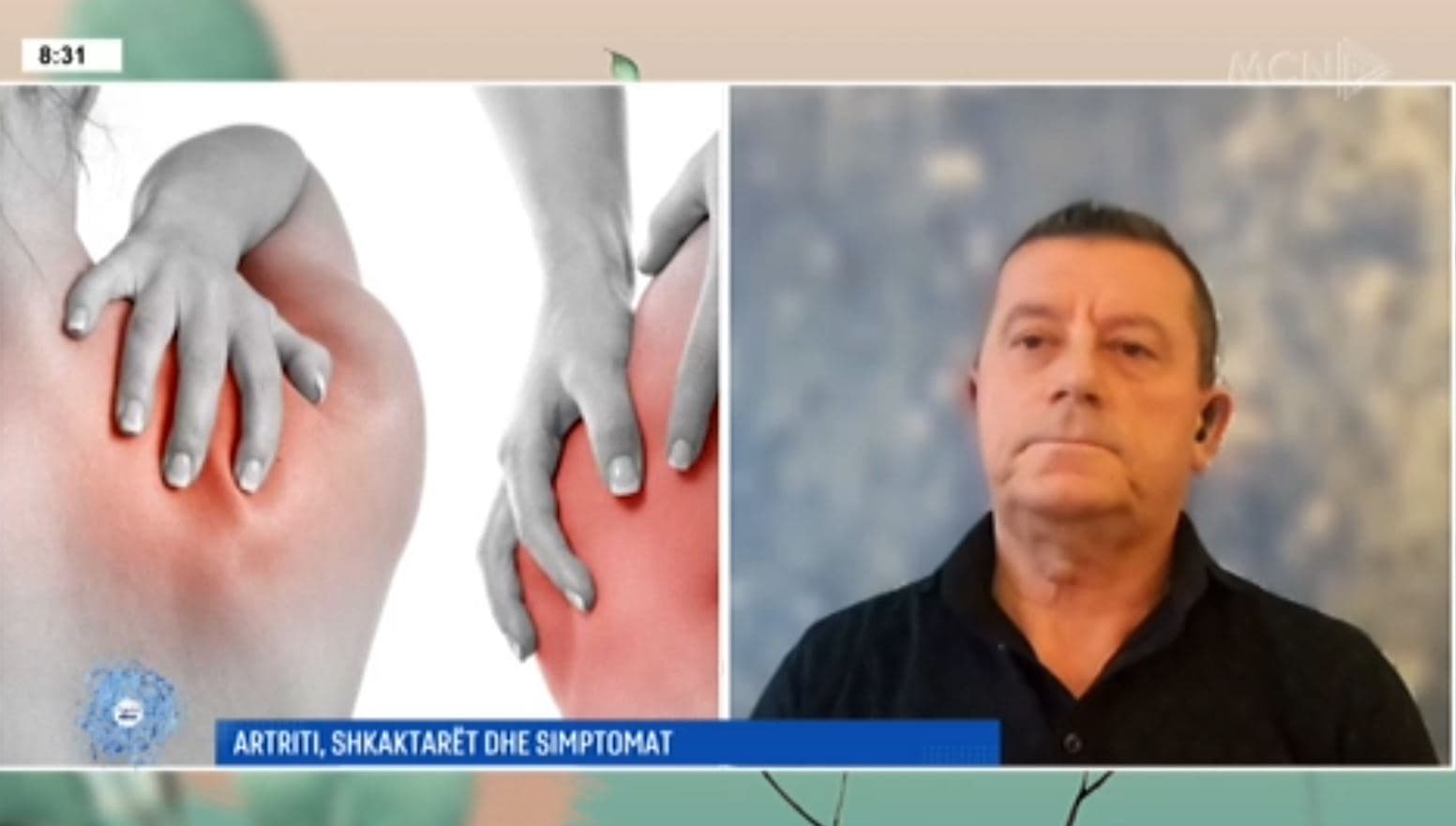 Nikola Ndoni ndan shkaqet e artritit dhe trajtimin e tij