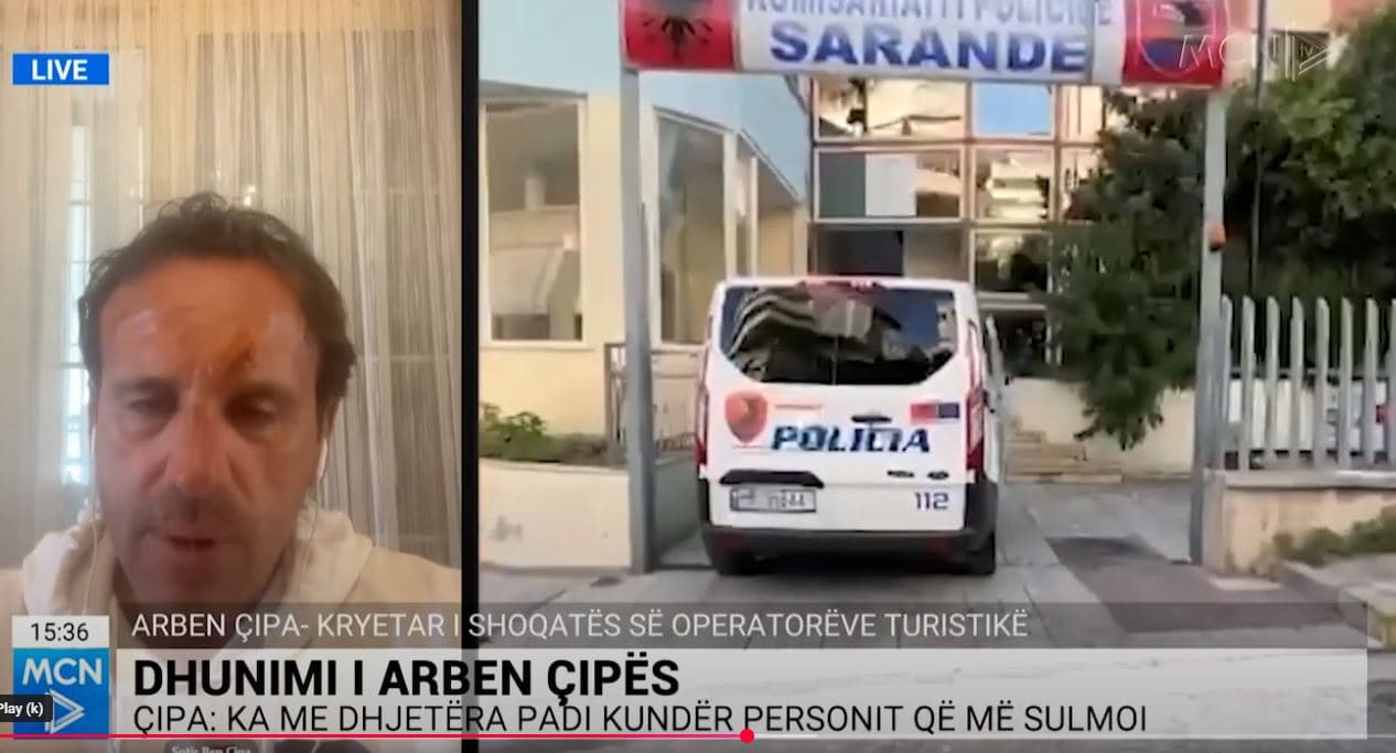Çipa: Asnjë konflikt interesi mes meje dhe personit që më dhunoi, ka me dhjetëra padi kundër tij (VIDEO)
