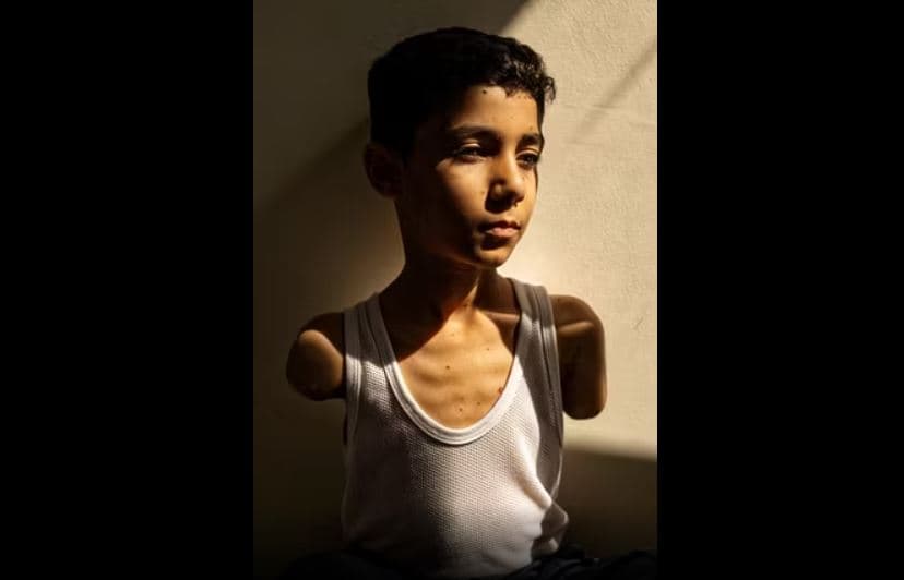 Gaza, imazhi i fëmijës palestinez të gjymtuar shpallet foto e vitit