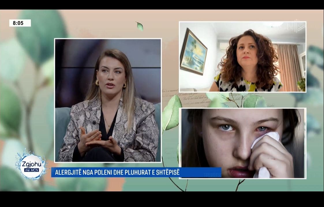 Alergjitë në pranverë/ Alergologia: Shenjat mos i ngatërroni me virozat. Okulistja: Kruarja e syve mund të shkaktojë hemorragji