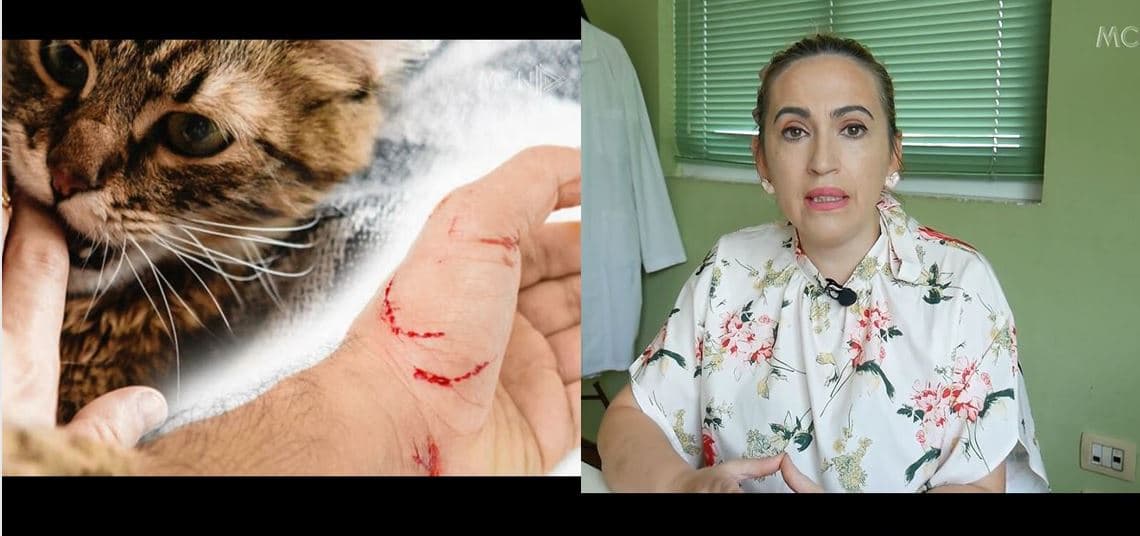 Këshillat e veterineres Mebelli: Ja si të trajtojmë plagët nga kafshimi i maceve dhe qenve