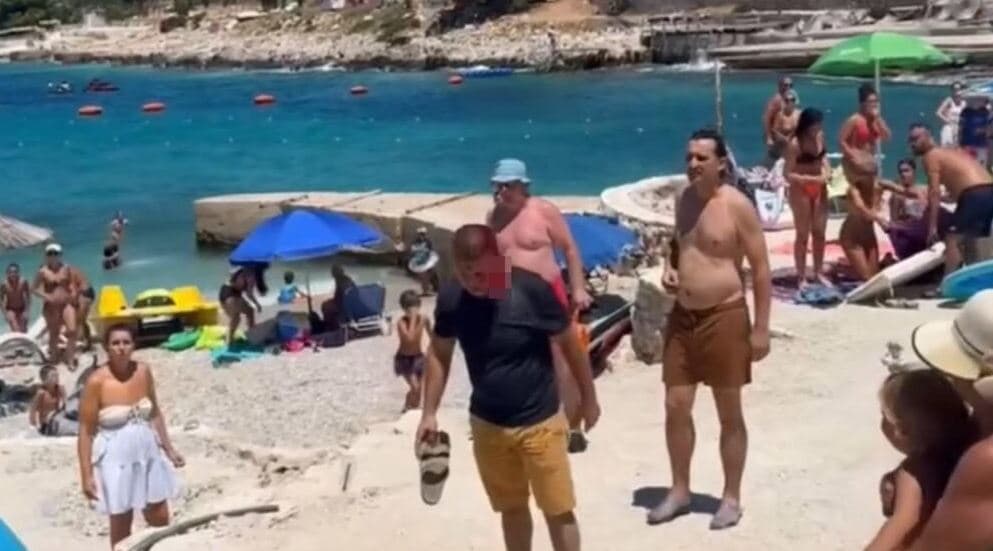 Ksamil/ Dhunuan me sende të forta 46-vjeçarin, arrestohen tre persona, një 17-vjeçar dhe bashkëshortja e të lënduarit nën hetim