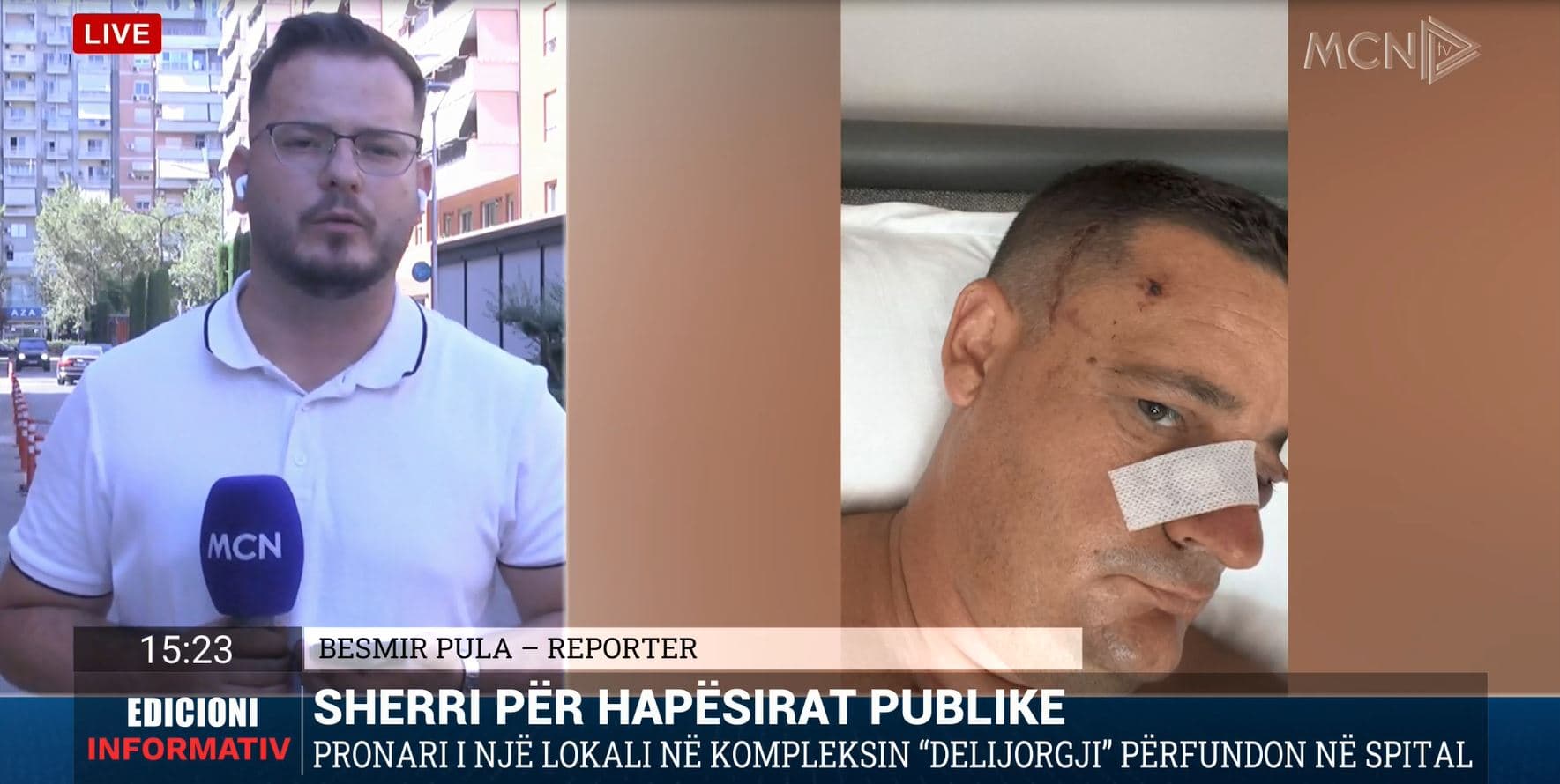 Dy vëllezërit dhunuan pronarin e lokalit/ Pula: Ngjarja pas dyshimeve se i kishte denoncuar për hapësirën e zënë publike (VIDEO)