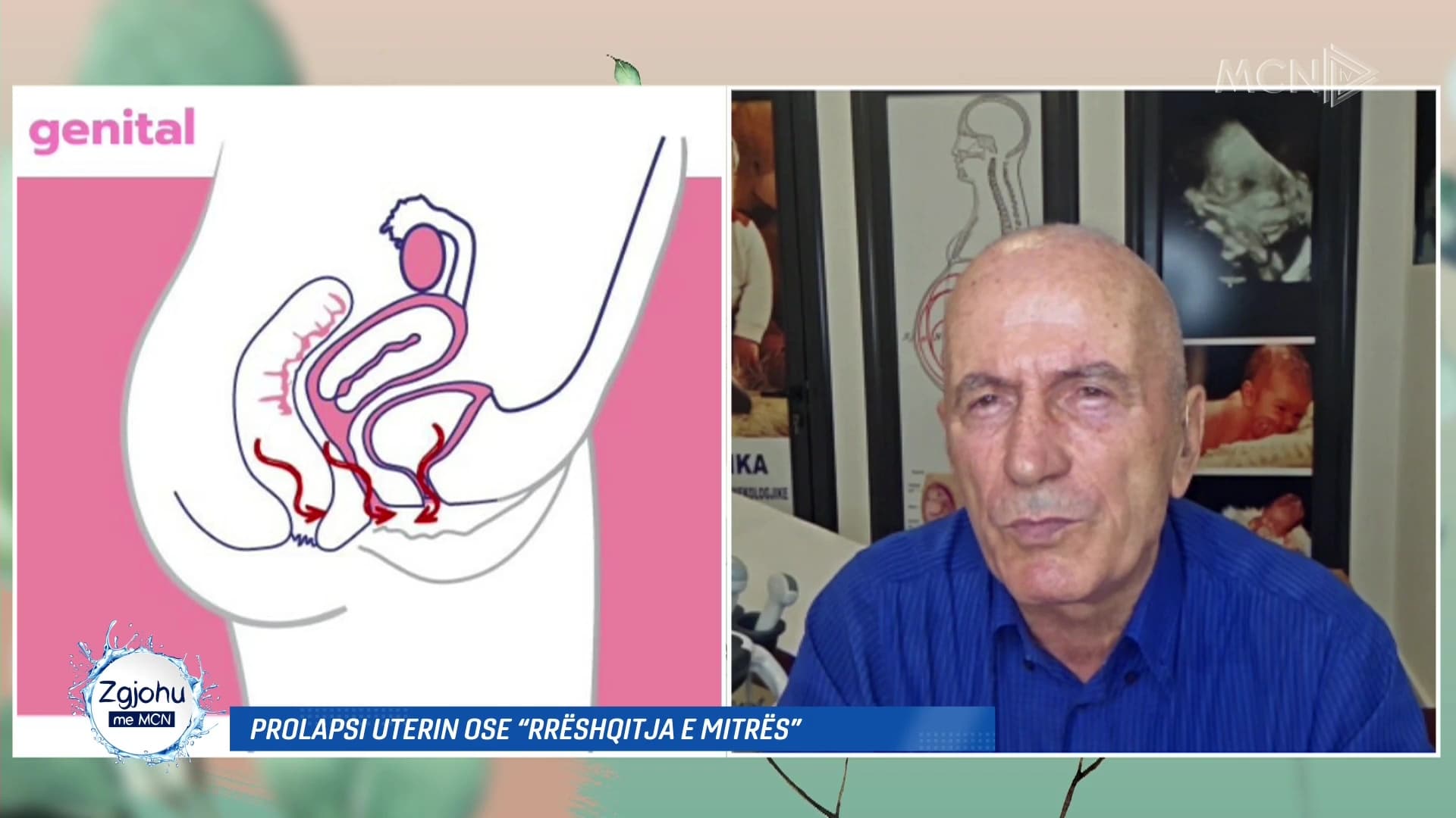 Prolapsi uterin ose ‘rrëshqitja e mitrës’/ Gjinekologu Haxhihyseni: Mos hiqni uterusin, zgjidhet me operacion
