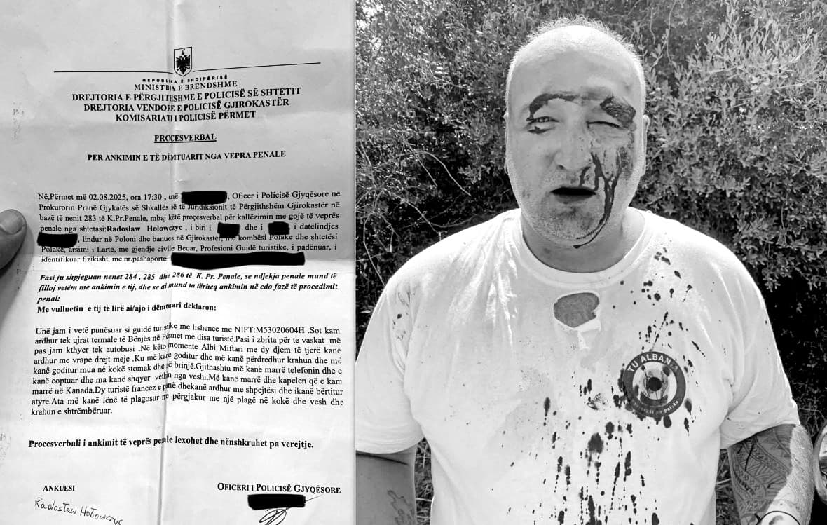 Guida polake sulmohet në Shqipëri/ Dëshmia e Hołowczyc: U dhunova brutalisht për arsye konkurrence!
