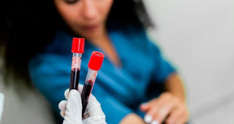 Studimi/ Një test i ri gjaku mund të përshpejtojë diagnostikimin e 50 llojeve të kancerit
