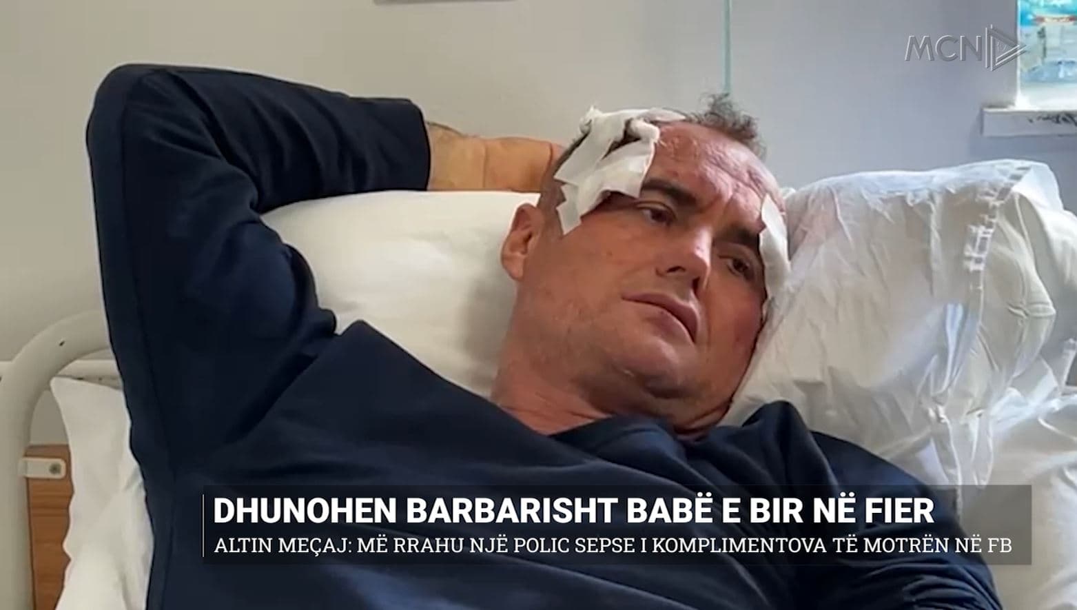 Dhunohen barbarisht babë e bir në Fier/ Altin Meçaj: Më rrahu një polic sepse i komplimentova të motrën në Facebook (VIDEO)