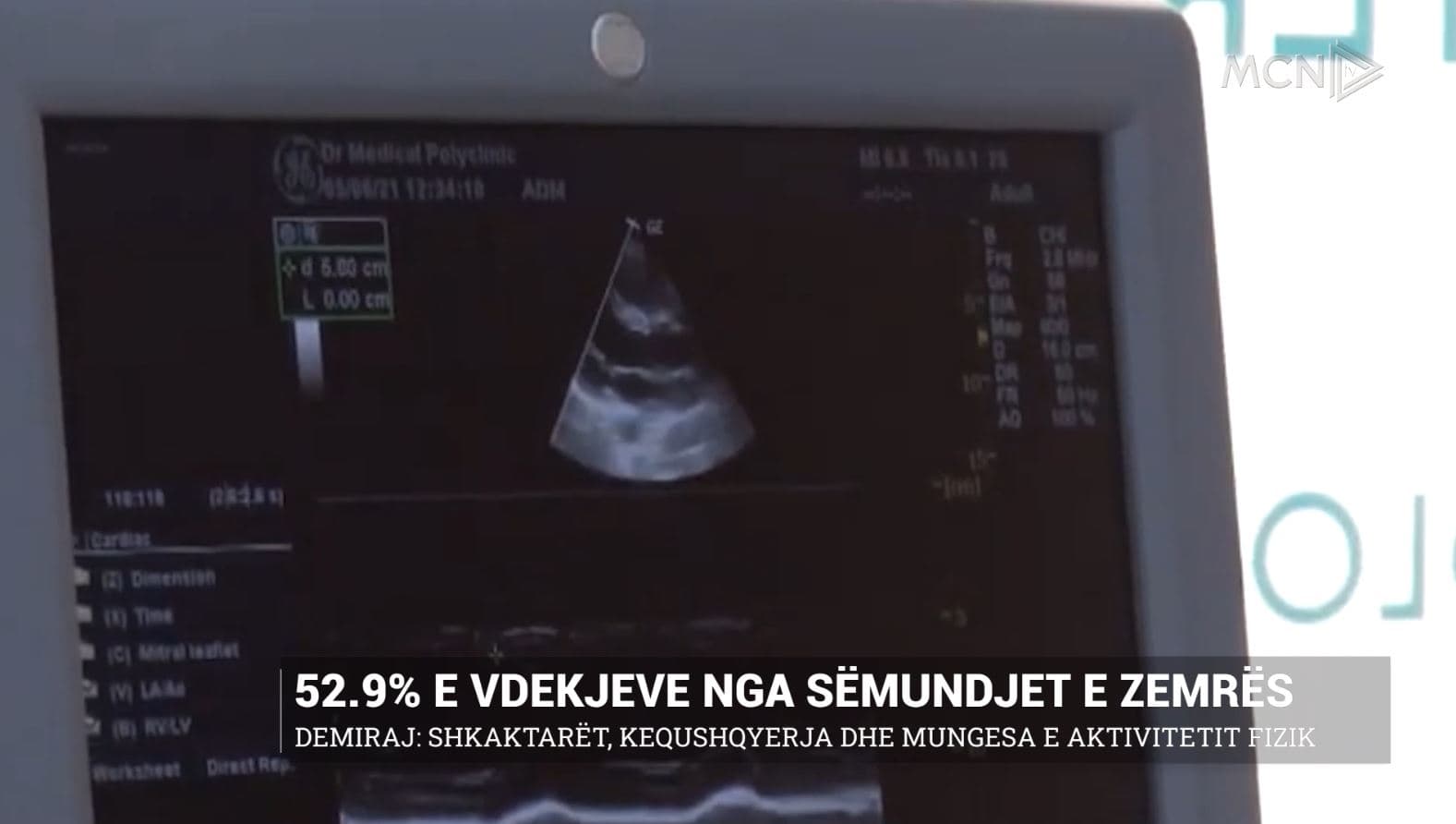 52.9% e vdekjeve nga sëmundjet e zemrës/ Mjeku: Kequshqyerja, mungesa e aktivitetit fizik shkaktarët kryesorë (VIDEO)