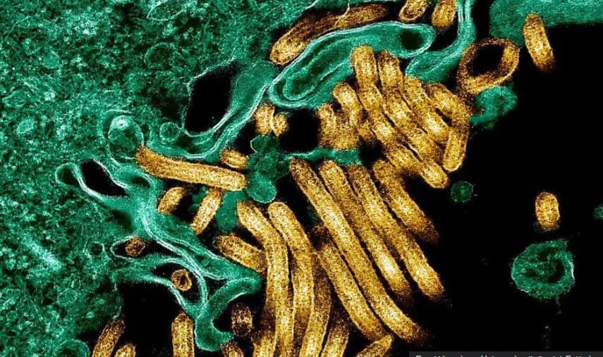 Shpërthim i ri i Ebolës në lindje të Kongos, 65 të vdekur dhe qindra të infektuar