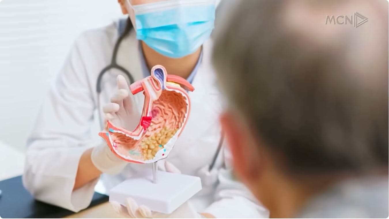 10% e vdekjeve nga kanceri i stomakut. Gastroenterologu: Helikobakteri, shkaktari kryesor