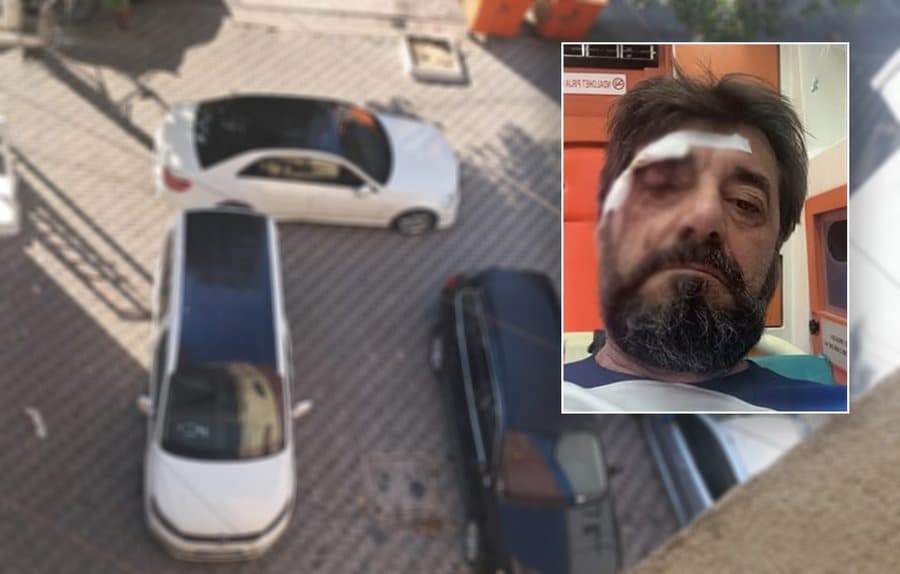 Goditet gazetari Ilir Demaliaj, autori i dyshuar shpallet në kërkim