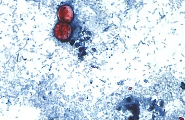 Shpërthim rekord i ciklosporës në Michigan, afro 1,000 të infektuar