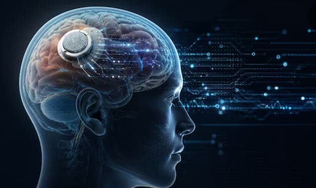 Kina vendos implantin e parë të çipit në tru, përpara Neuralink