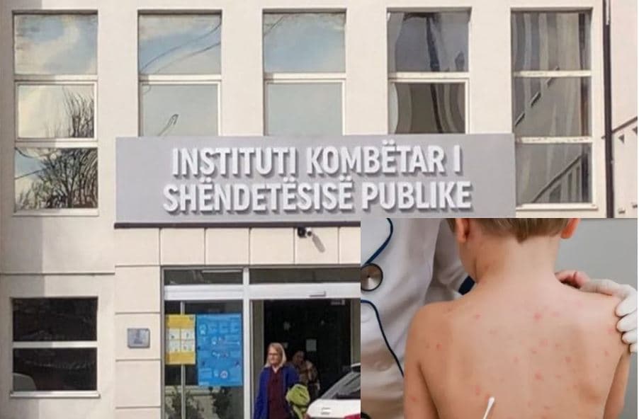 Fruthi në Kosovë/ 112 raste të regjistruara, 50 të reja në një muaj