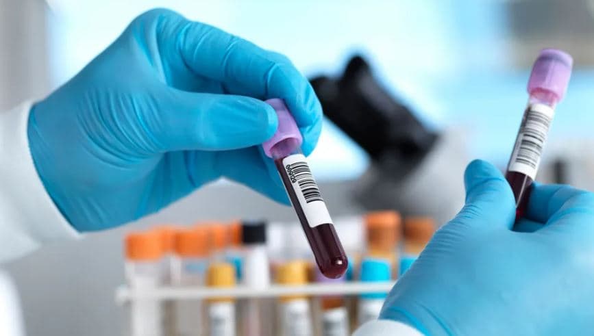 Anglia drejt eliminimit të hepatitit C, mbi 100 mijë persona janë diagnostikuar dhe trajtuar