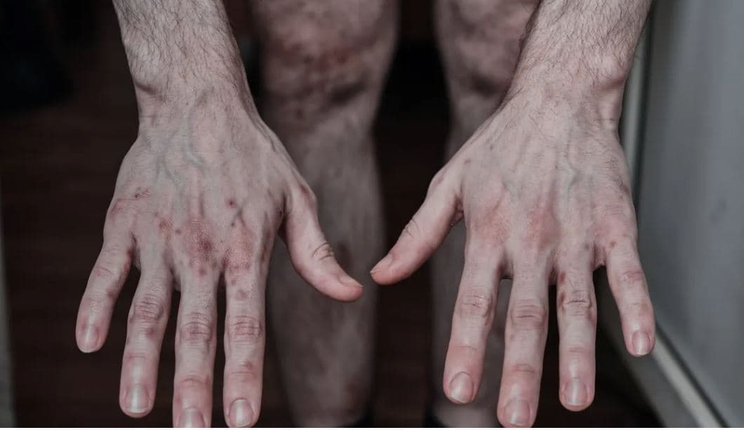 Raporti i OKB-së/ Rusia përgjegjëse për 89% të dhunës seksuale në luftën e Ukrainës