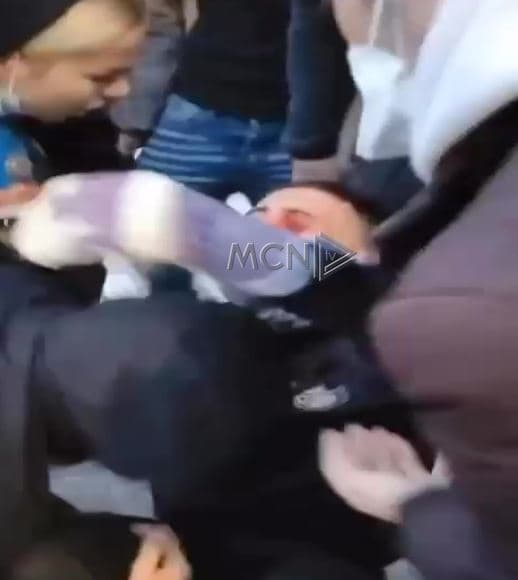 Një i ri qëllohet me plumb gome në sy, transportohet me urgjencë te Trauma
