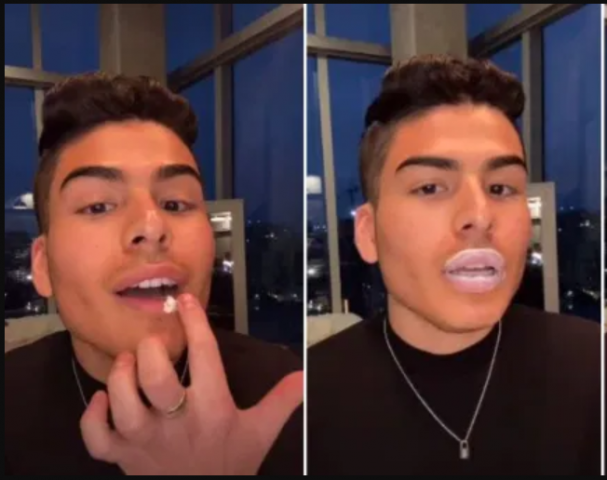 Doktorët paralajmërojnë për trendin në TikTok që të zmadhon buzët