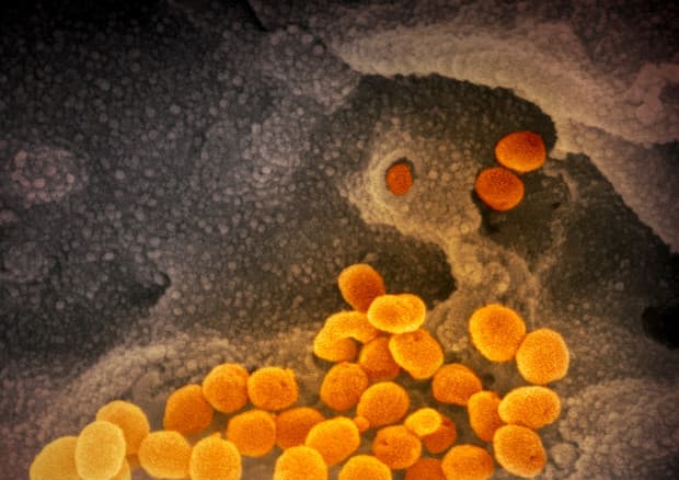 Koronavirus, antitrupat e vaksinës italiane funksionojnë