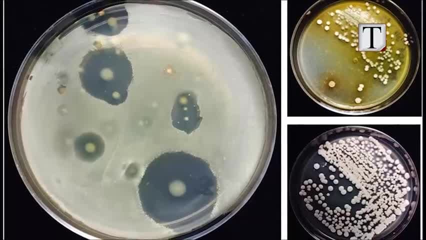 BE ndalon përdorimin e antibiotikëve në mjekësinë veterinare (VIDEO)