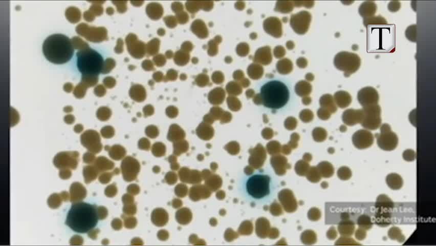 Rritet imuniteti ndaj antibiotikëve, paralajmërohet shtim i vdekjeve (VIDEO)