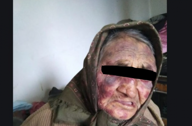 Horrori në Divjakë/ Arrestohet 36-vjeçari, nën akuzë se dhunoi dhe përdhunoi gjyshen 89-vjeçare