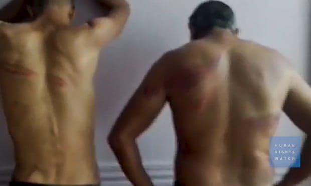Human Rights Watch, akuzon policinë greke për rrahjen e emigrantëve që kalojnë kufirin nga Turqia