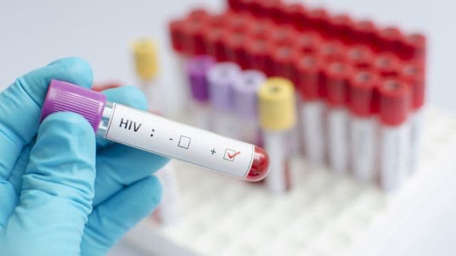 Shpresë për parandalimin e virusit HIV, një vaksinë premtuese testohet te njerëzit
