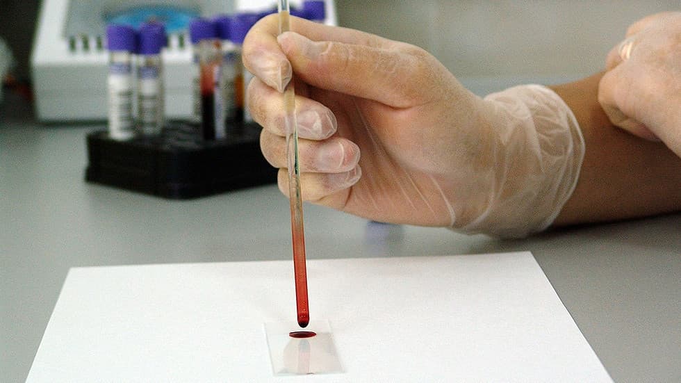 Shpikja e re: Të diagnostikosh kancerin nga një pikë e vetme gjaku