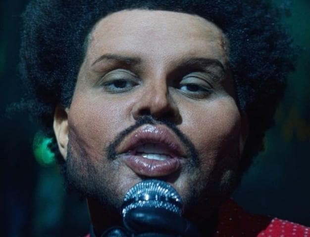 Çfarë ka ndodhur me fytyrën e The Weeknd?