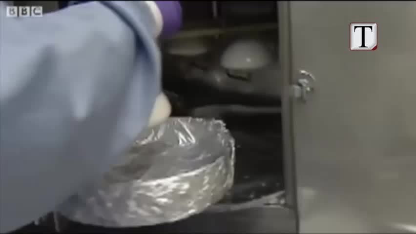 Pajisjet mjekësore dëmtojnë pacientët në mbarë botën (VIDEO) 