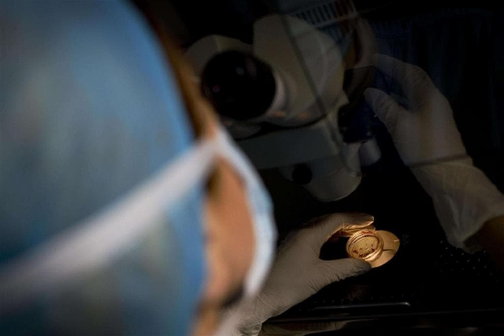 Shkenca bën një hap të madh duke krijuar embrionet e deleve për organet e transplantimit