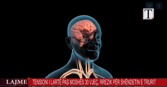 Tensioni i lartë pas moshës 30 vjeç, rrezik për shëndetin e trurit (VIDEO)