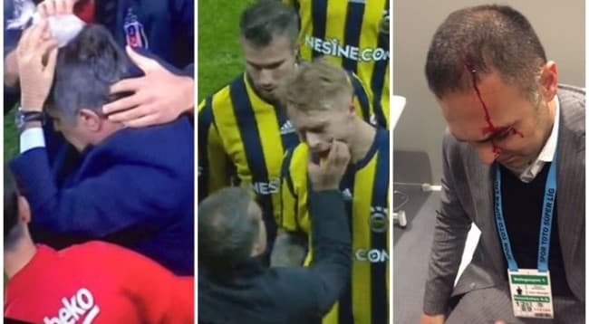 Ndërpritet derbi Stambollit Fenerbahce-Besiktas, tifozët godasin trajnerin (VIDEO)