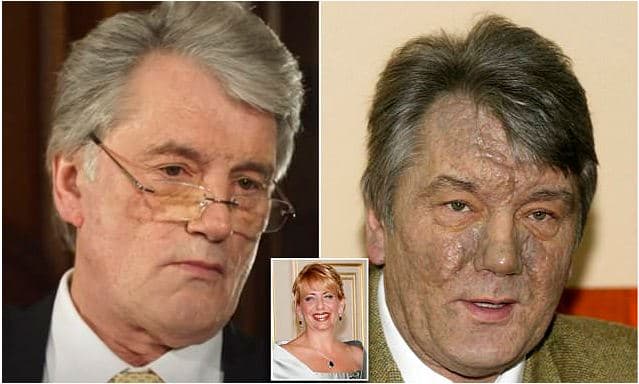 Ish-presidenti Ukrainës tregon kur e helmuan 14 vjet më parë, kërkesë Evropës të zgjohet nga kërcënimi rus (FOTO)
