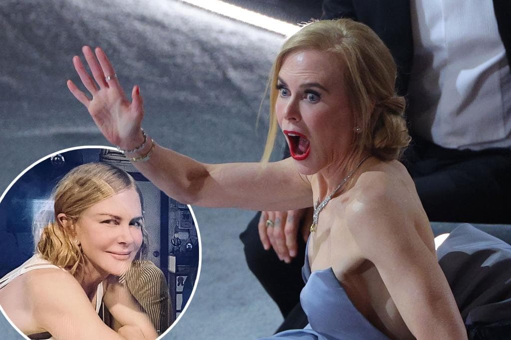 Fansat akuzojnë Nicole Kidman për ndërhyrje estetike (FOTO)