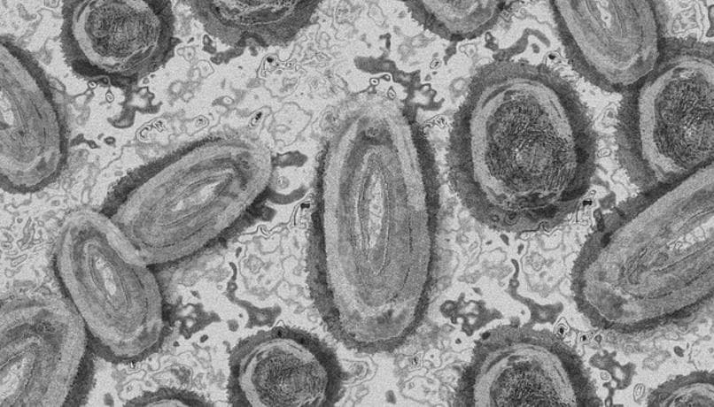 EMA: Përhapja e lisë së majmunit kërkon një përgjigje të fortë dhe efektive