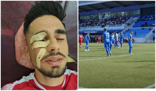 Goditi futbollistin e Partizanit, shpallet në kërkim tifozi i Kukësit
