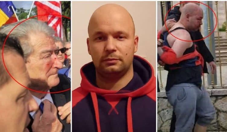 Goditi me grusht Berishën/ Shtyhet seanca për Gerti Shehin, shkak mungesa e ish-kryeministrit