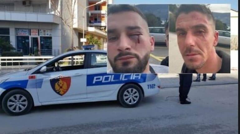 Dhuna ndaj 3 të rinjve/ Klodjan Meaj: U sulmuam befasisht, shkak mund të jetë bërë flamuri kuqezi