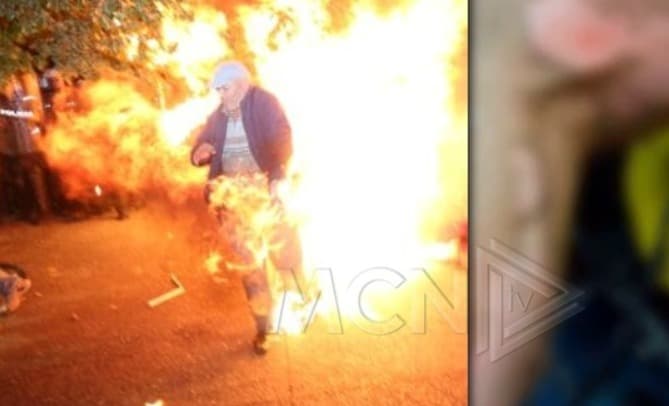 Emri/ Protestuesi digjet nga molotovët e hedhur në protestë
