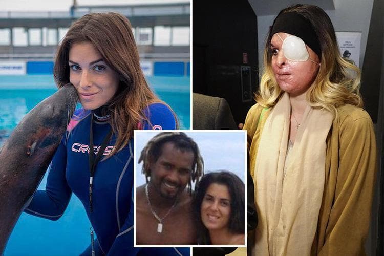 Sulmoi me acid në fytyrë finalisten e Miss Italia, gjykata e dënon me 15 vjet burg