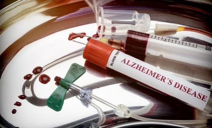 Testi i ri i gjakut parashikon nëse do keni sëmundjen e Alzheimer (VIDEO)