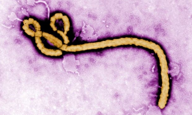 Bllokohet spitali në Suedi, dyshohet për një rast të virusit Ebola