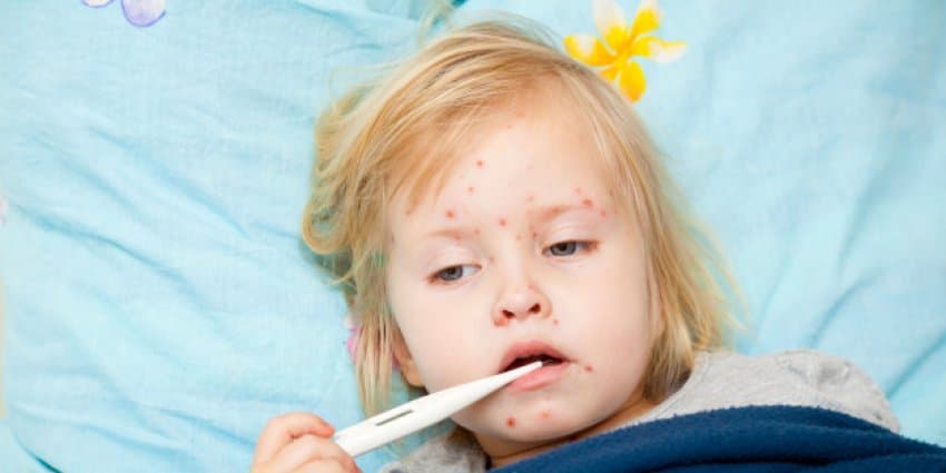 Epidemia e fruthit në Evropë, numri i të prekurve u katërfishua në 2017-n