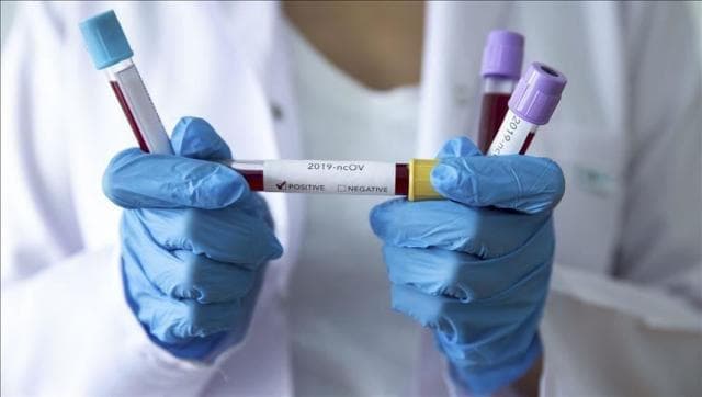 Bie sërish numri i rasteve të reja me koronavirus